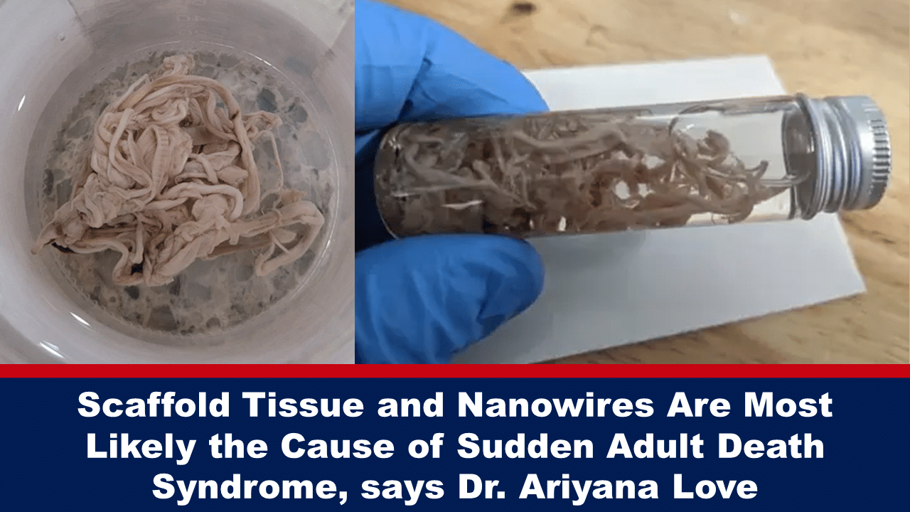 Featured28b - The Expose