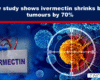 - The Expose Expose News: New study claims ivermectin reduces brain tumors by 70%! Eye-catching medical discovery sparks excitement in healthcare world.