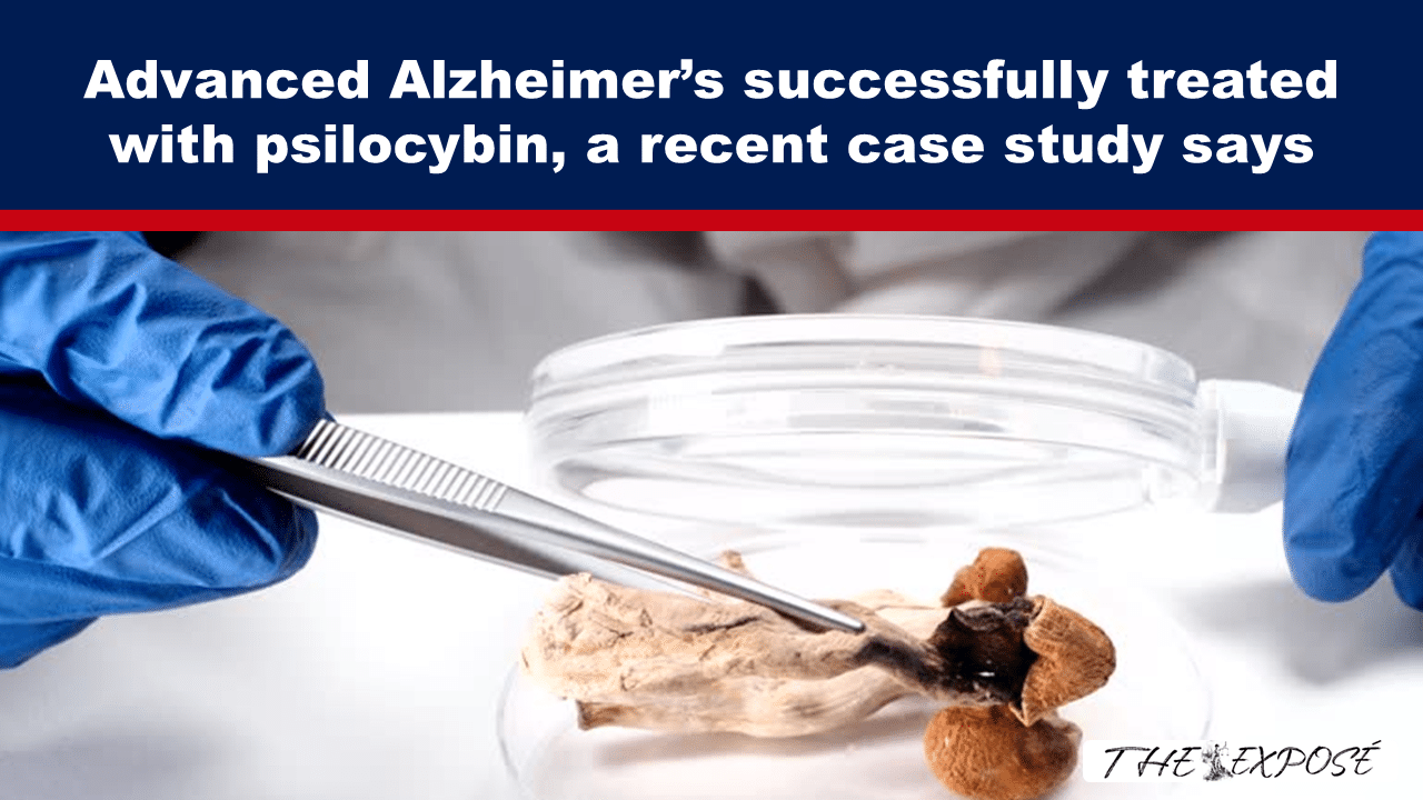 JunFeat8c - The Expose Lab scene: gloved hands use tweezers to handle a tissue sample beside a clear dish, with a bold headline about Alzheimer's treatment.